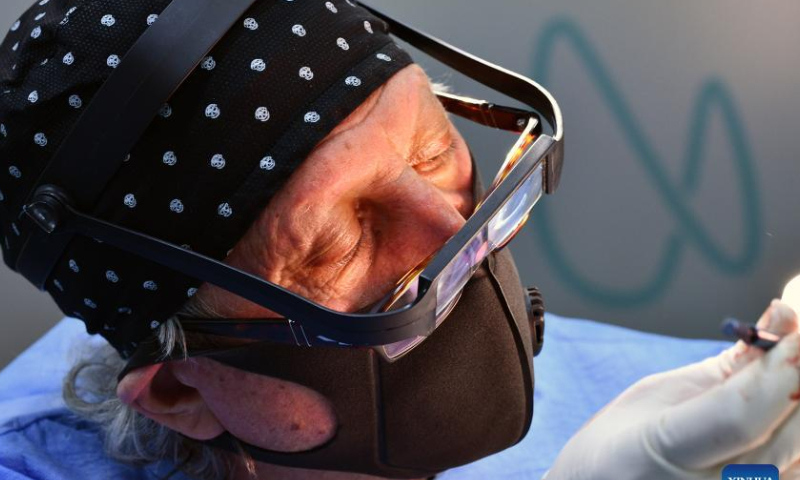 A Turkish doctor conducts hair implantation for a patient in Bursa, Türkiye, on Aug. 11, 2022.  Photo: Xinhua