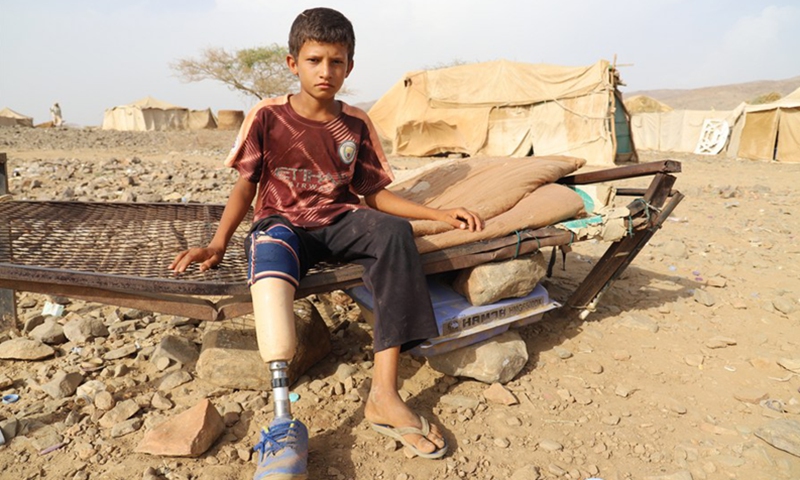 A displaced boy who lost his right leg in a landmine explosion is seen at a displaced camp in Haradh District in Hajjah province, Yemen, April 7, 2020.(Photo: Xinhua)