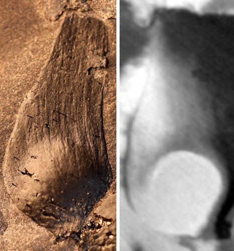 Fruits of Qingganninginfructus formosa and contained seeds Photo: Courtesy of the Nanjing Institute of Geology and Palaeontology, Chinese Academy of Sciences