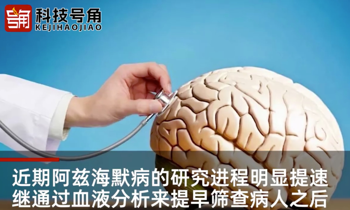 Researchers at the University of Alberta in Canada recently stated in a paper that they are developing a machine-learning model that can be accessed via smartphones to identify early symptoms of Alzheimer’s disease by analyzing acoustic and speech characteristics. Photo: web