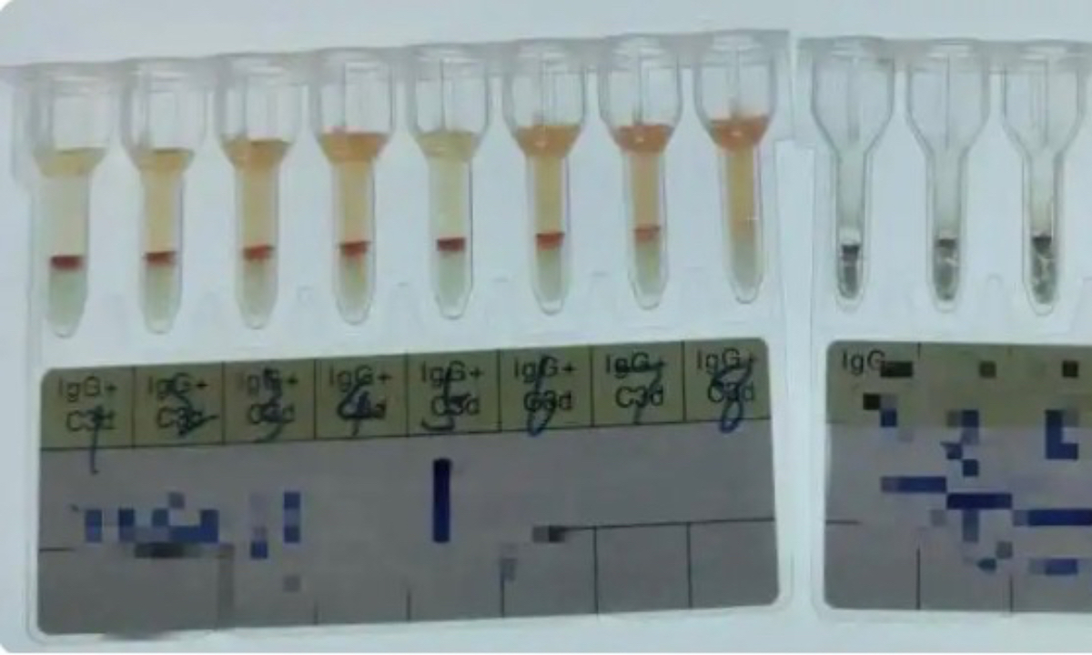 Blood Sample Photo: Courtesy of Wenshan central blood station