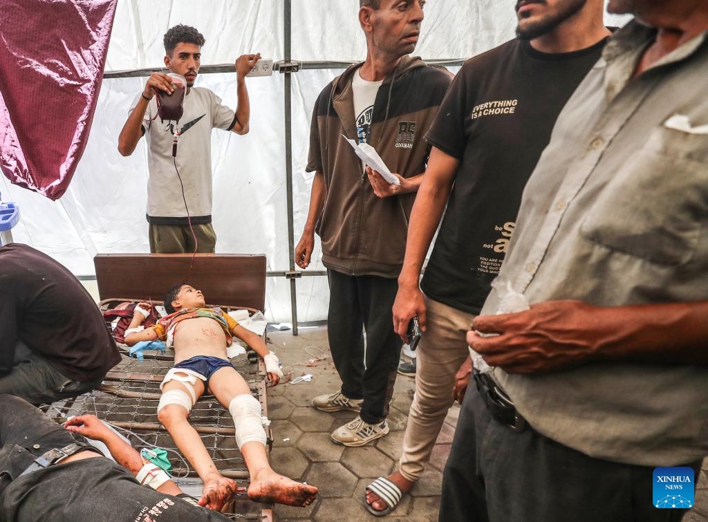 A wounded Palestinian boy is seen at a hospital following an Israeli airstrike in Gaza City, on July 13, 2025. At least 58 Palestinians were killed by Israeli airstrikes and gunfire across the Gaza Strip on Sunday, Palestinian sources said. (Photo: Xinhua)