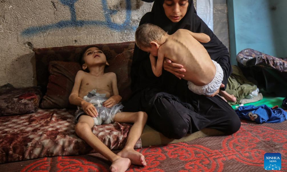 Two displaced Palestinian children suffering from malnutrition and cerebral palsy are seen inside a school-turned shelter in the northwest of Gaza City, July 25, 2025. (Photo by Rizek Abdeljawad/Xinhua)