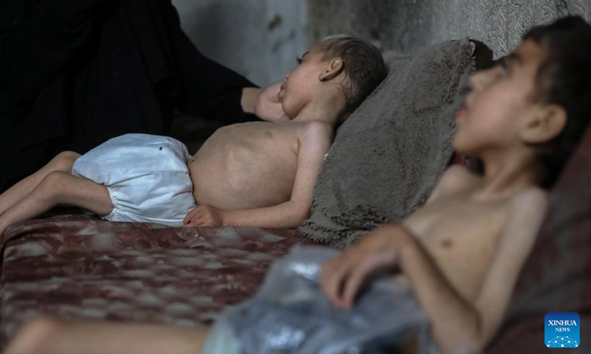 Two displaced Palestinian children suffering from malnutrition and cerebral palsy are seen inside a school-turned shelter in the northwest of Gaza City, July 25, 2025. (Photo by Rizek Abdeljawad/Xinhua)