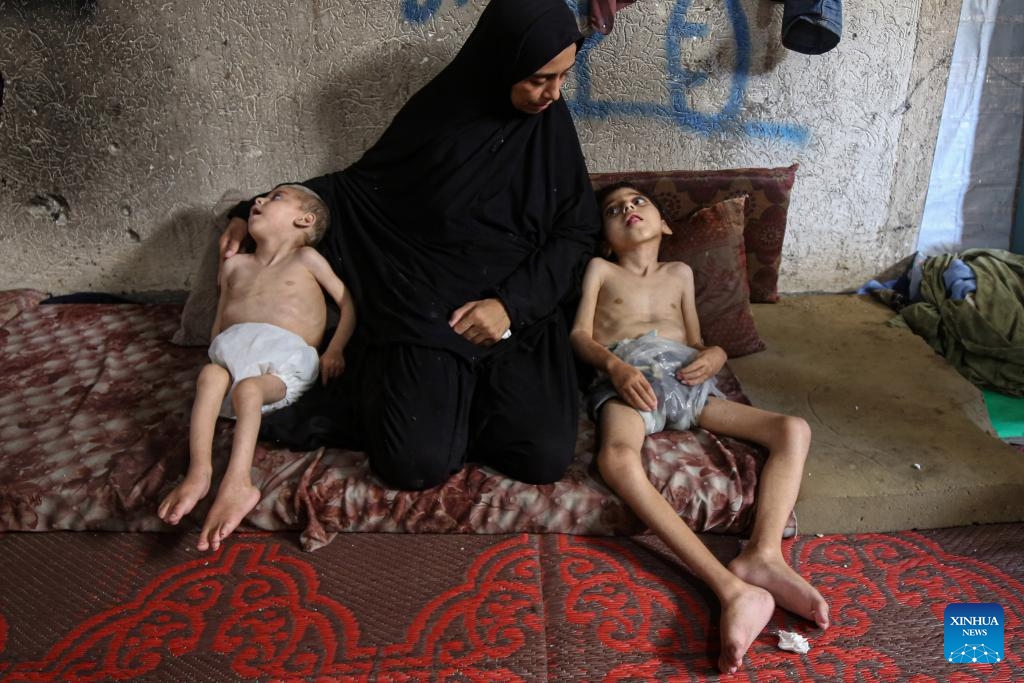 Two displaced Palestinian children suffering from malnutrition and cerebral palsy are seen inside a school-turned shelter in the northwest of Gaza City, July 25, 2025. (Photo: Xinhua)