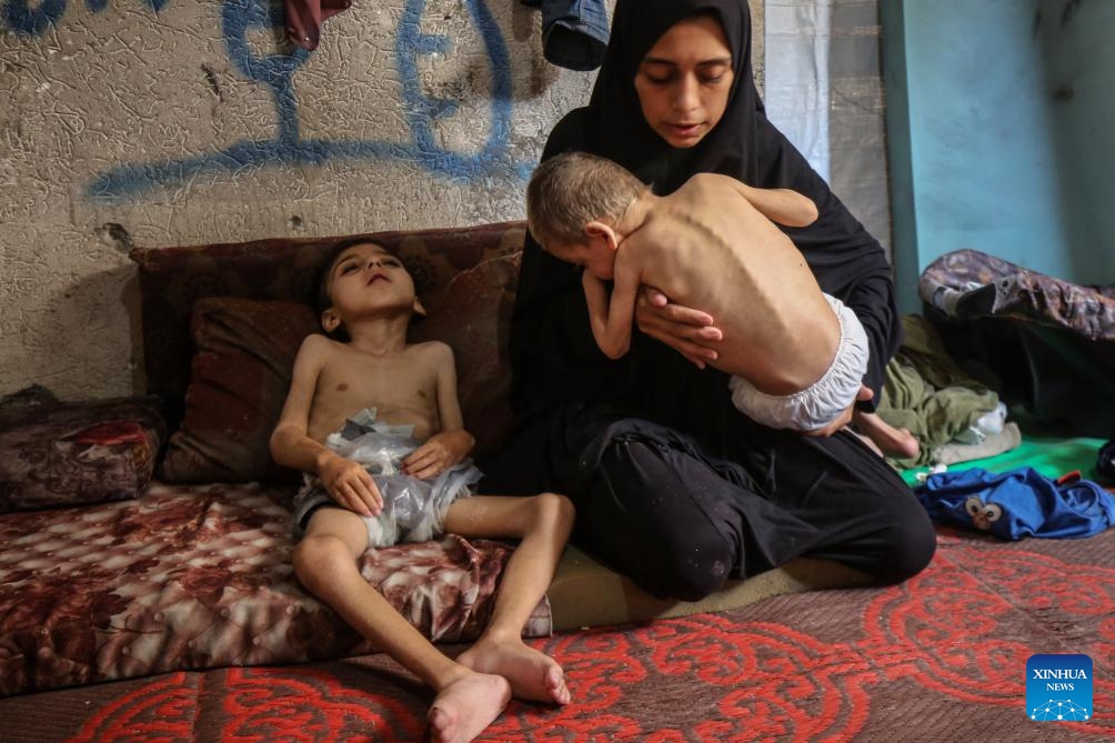 Two displaced Palestinian children suffering from malnutrition and cerebral palsy are seen inside a school-turned shelter in the northwest of Gaza City, July 25, 2025. (Photo: Xinhua)