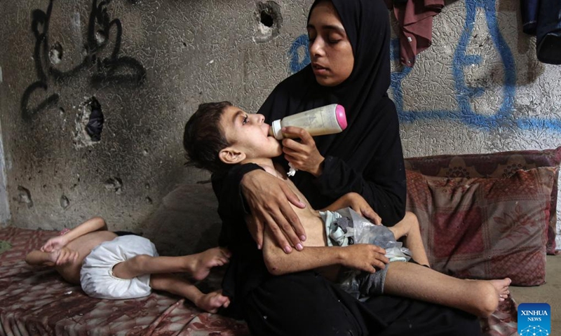 Two displaced Palestinian children suffering from malnutrition and cerebral palsy are seen inside a school-turned shelter in the northwest of Gaza City, July 25, 2025. (Photo: Xinhua)