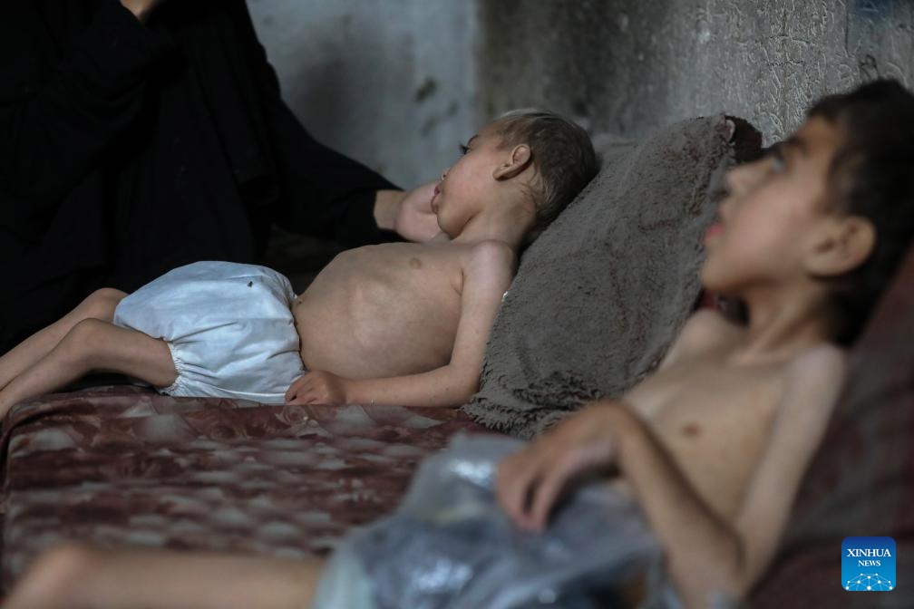 Two displaced Palestinian children suffering from malnutrition and cerebral palsy are seen inside a school-turned shelter in the northwest of Gaza City, July 25, 2025. (Photo: Xinhua)