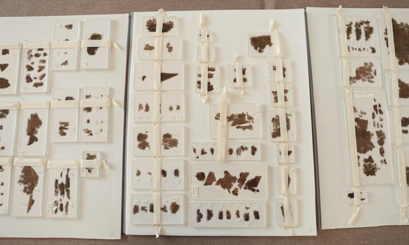 Volume II and III of the Zidanku Silk Manuscripts Photo: Courtesy of China's National Cultural Heritage Administration