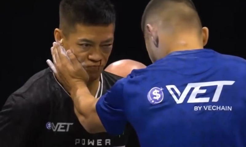 Chinese athlete Zhao Honggang faced Kazakhstan's Mukhammed Amantayev on Friday night in the third round in the World Slap Fighting Championship. He was knocked out and fell to the ground in visible pain. Photo: Courtesy of China News Service
