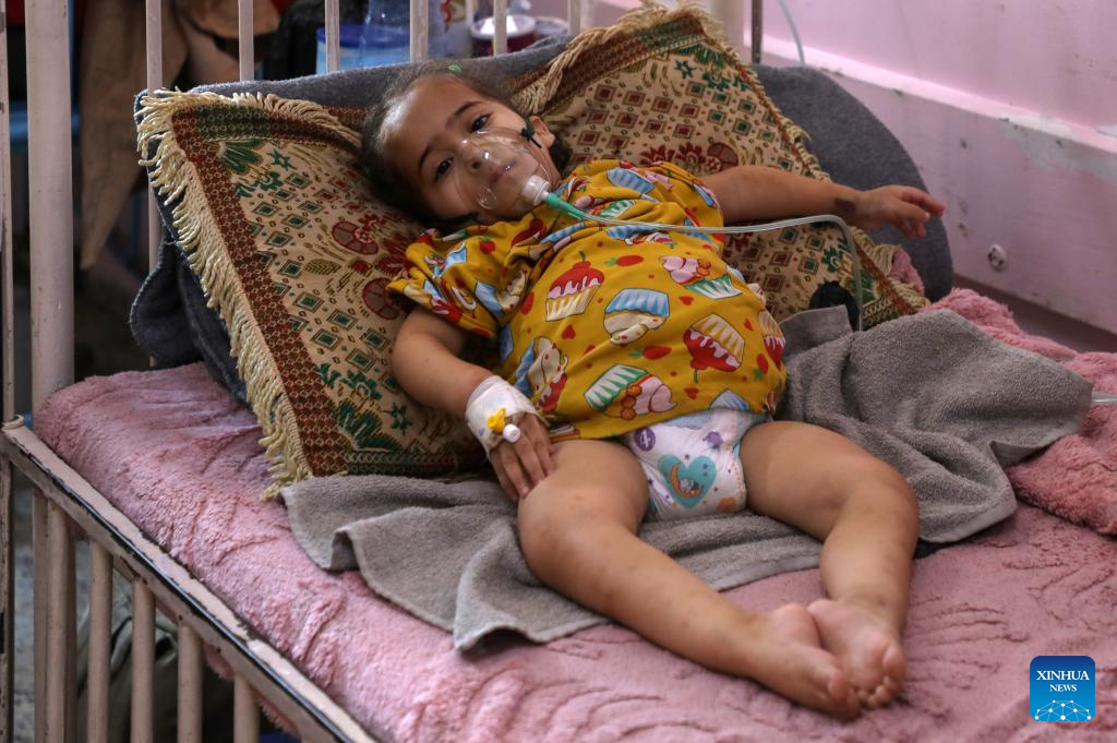 A Palestinian child receives treatment at Nasser Medical Complex in Khan Younis, southern Gaza Strip, on Dec. 1, 2025, while awaiting Israeli permission to travel abroad for critical medical care. (Photo by Rizek Abdeljawad/Xinhua)