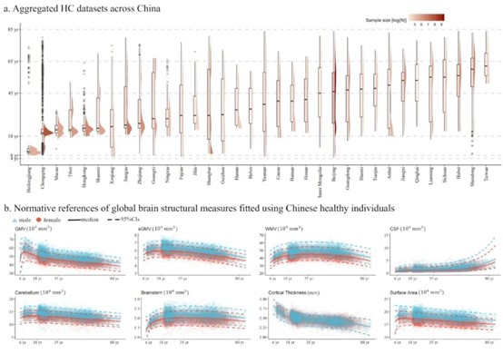 Sample distribution in the general population and the developmental and aging trajectories of brain structure across the lifespan. Photo: Beijing Tiantan Hospital