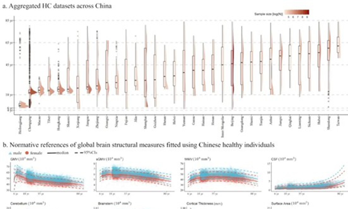 Chinese researchers construct healthy reference chart for brain structure for Chinese population, to facilitate diagnosis and precision treatment