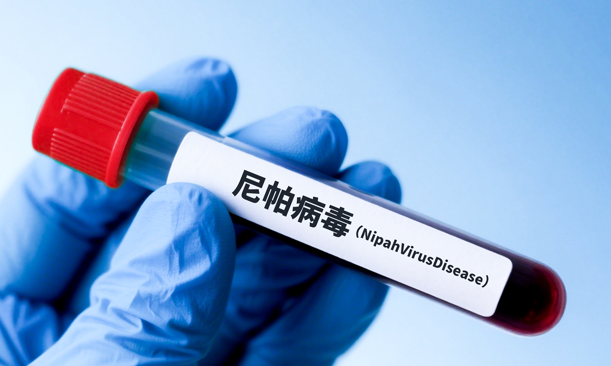 File photo of the Nipah virus disease. Photo: VCG