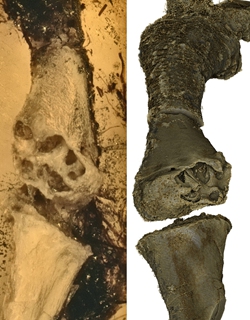 The impact of giant cell tumors on lizard joints Photo: Courtesy of Xing Lida