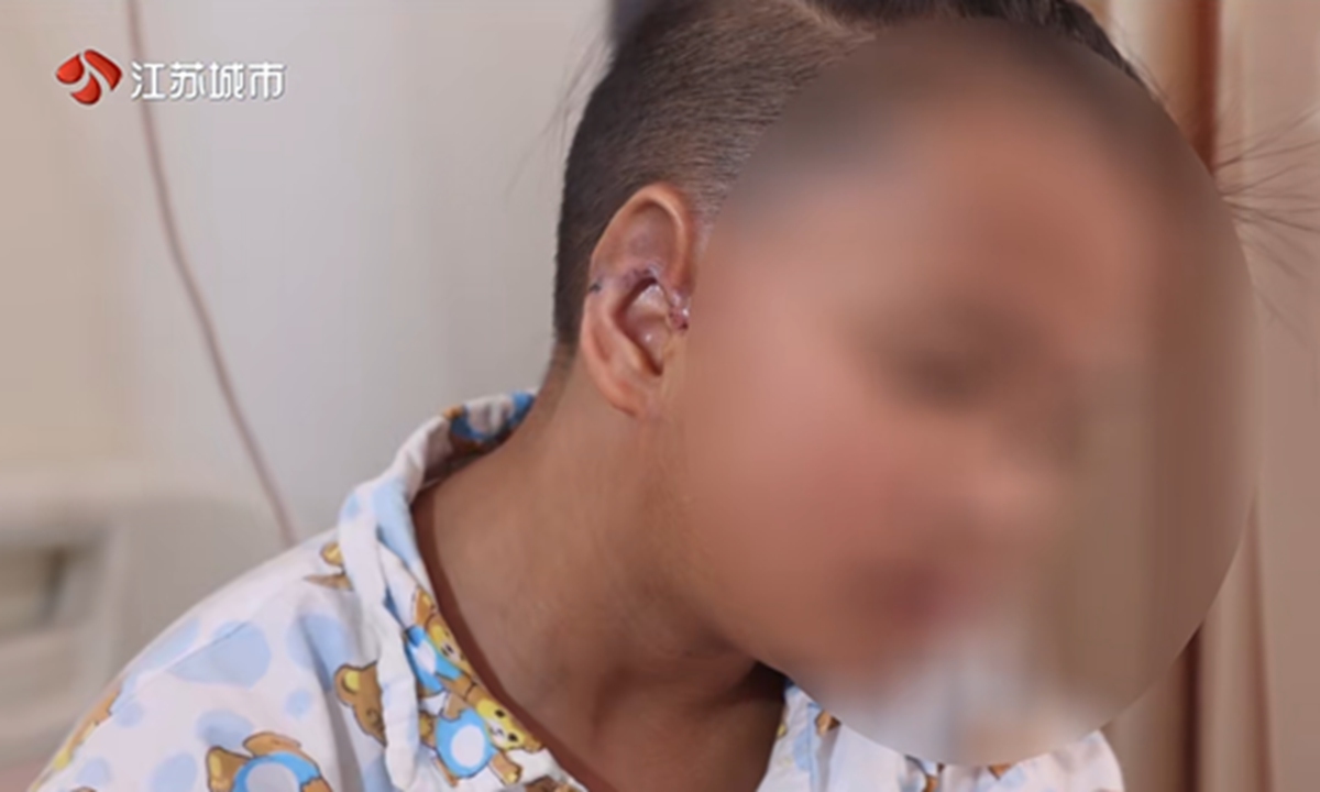 Screenshot of Dawa after the surgery