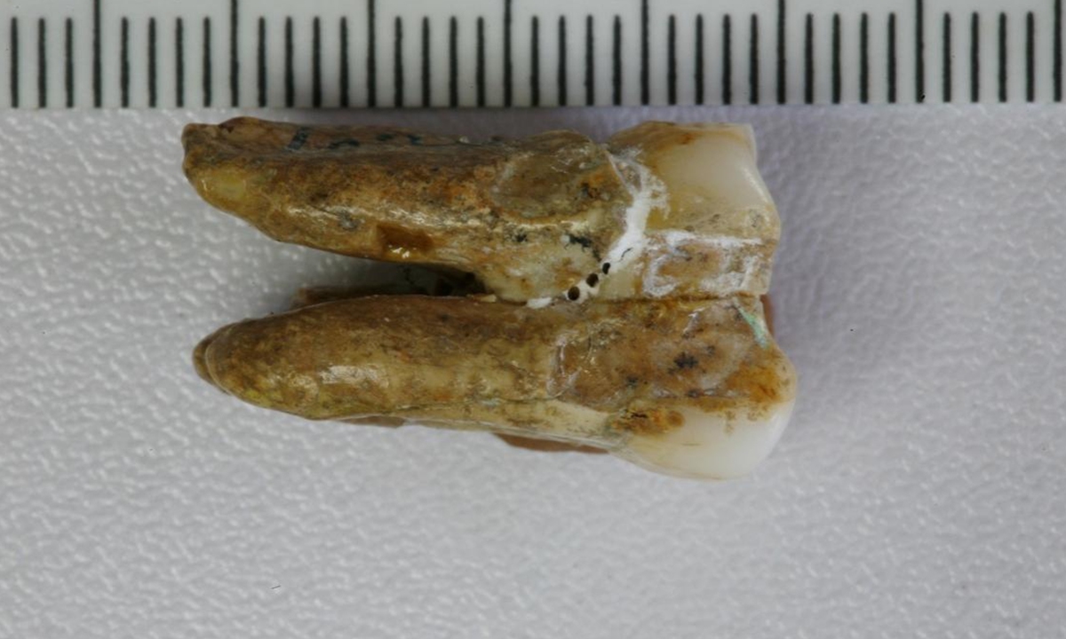 The tooth from the Zhoukoudian site Photo: Courtesy of Fu Qiaomei from the Institute of Vertebrate Paleontology and Paleoanthropology, Chinese Academy of Sciences 