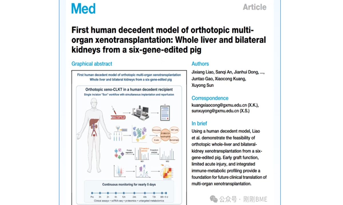 A screenshot of the paper by Professor Sun Xuyong's team published in the academic journal Med, a Cell Press journal. Photo: official WeChat account of the Second Affiliated Hospital of Guangxi Medical University