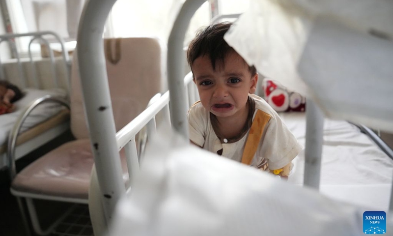 A malnourished child is pictured at the Indira Gandhi Institute of Child Health in Kabul, Afghanistan, July 13, 2026. The UN Children's Fund (UNICEF) has raised the alarm that 3.7 million children under the age of 5 in Afghanistan are at heightened risk of malnutrition, according to a new report issued on Sunday. (Photo: Xinhua)