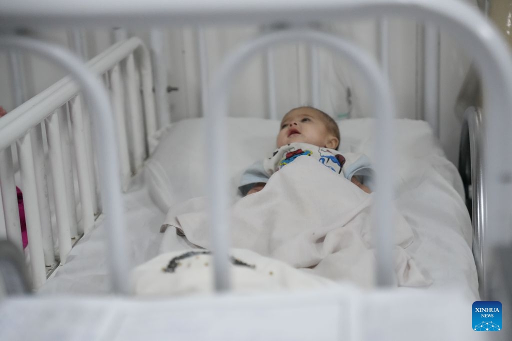 A malnourished child is pictured at the Indira Gandhi Institute of Child Health in Kabul, Afghanistan, July 13, 2026. The UN Children's Fund (UNICEF) has raised the alarm that 3.7 million children under the age of 5 in Afghanistan are at heightened risk of malnutrition, according to a new report issued on Sunday. (Photo: Xinhua)