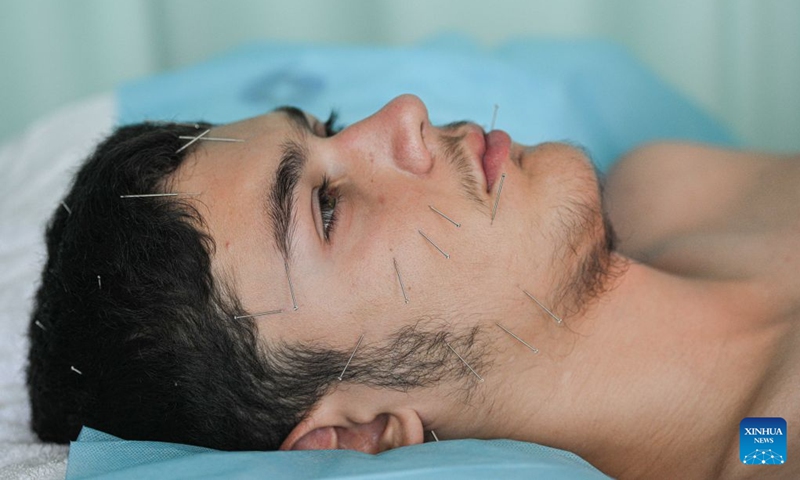 A foreigner experiences acupuncture at Sanya International Friendship Sanatorium of Traditional Chinese Medicine (TCM) in Sanya, south China's Hainan Province, Aug. 27, 2026. Photo: Xinhua