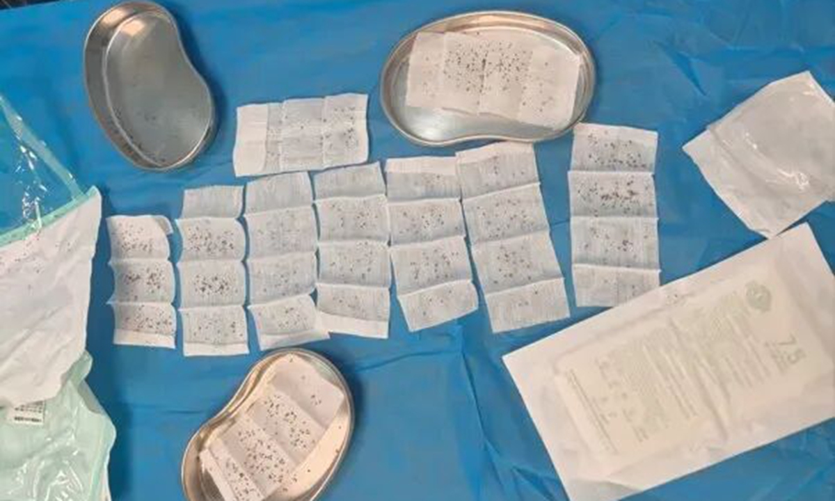 Bee stingers removed by doctors from the man after the swarm attack. Photo: Guangming Online